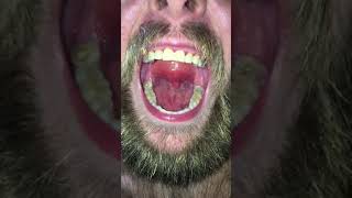 Swallowing his tongue part 1