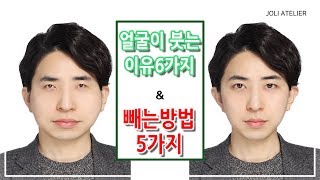 팅팅 부은내얼굴ㅠㅠ 얼굴이 붓는 이유 6가지 \u0026 빼는방법 5가지 [아름다운작업장]