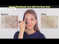 how to remove blackheads at home skinmiso yesstyle korean beauty