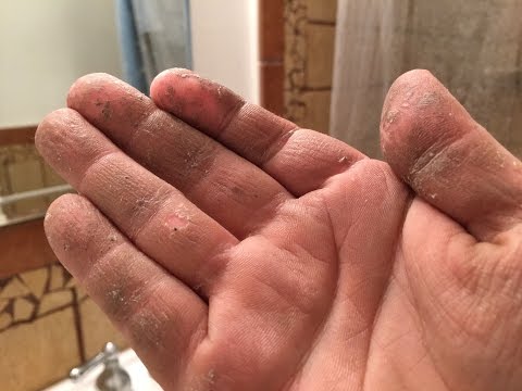How to REALLY Remove Sticky Crazy Glue or Spray Foam Adhesive Chemicals from your hands How to REALLY Remove Sticky Crazy Glue or Spray Foam Adhesive Chemicals from your hands