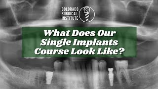 Excel in Single Implant Dentistry with Colorado Surgical Institute's Comprehensive Course