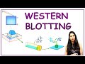 WESTERN BLOTTING I Protein Detection I Tools & Technique I Methods in Biology