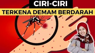 APA SAJA TANDA DAN CIRI TERKENA DEMAM BERDARAH DBD?