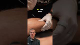 Twitch Response While Dry Needling the Calf