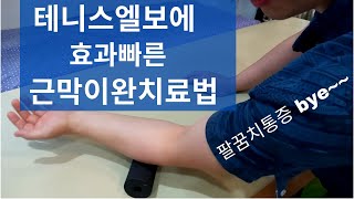 팔꿈치 통증 테니스엘보치료법-근막이완으로 빠른효과를 볼수 있습니다