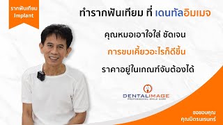 เจ็บน้อยกว่าถอนฟัน!! | ทำรากเทียมไม่ได้น่ากลัวอย่างที่คิด | รากฟันเทียม By Dentalimage | คุณหมอธนกฤต