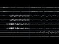 vldc9 abstract map oscilloscope view