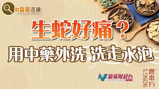 農本方特約：【中醫藥透視】帶狀皰疹生蛇（嘉賓：香港防癆會中醫診所 李凱琳中醫師）