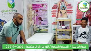 طريقه عمل الحجامة الجافة في المنزل | حصة تدريبية | في مركز أبو عمران للحجامة والعلاج الطبيعي