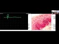 Human Anatomy and Physiology, Chapter 4: Tissue: The Living Fabric_ Part 1 (B)