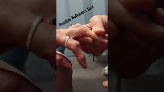 Positive Hoffman’s Test in slow motion! #shorts #hoffman’stest #orthoevalpal