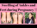 Swelling of Ankles and Feet during Pregnancy !! (English)