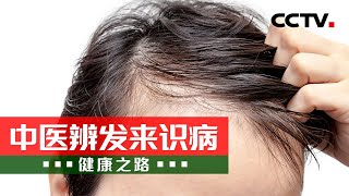 “脱发星人”有救了！快跟随中医专家学习治疗脱发的小妙方吧！20220525 |《健康之路》CCTV科教