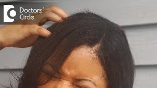 Reasons for itchy scalp and how to treat it - Dr. Rasya Dixit