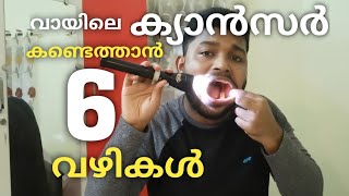 വായിൽ ക്യാൻസർ ലക്ഷണങ്ങൾ ഉണ്ടോ എന്ന് പരിശോധിച്ചു നോക്കൂ//Oral Cancer Screening at Home//SachiZ DaLe