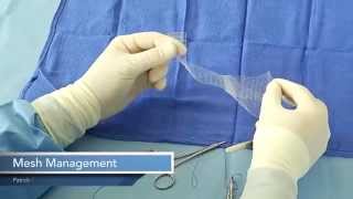 MESH MANAGEMENT for Robotic Sacrocolpopexy