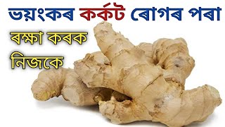 আদাৰ ১০টা প্ৰধান উপকাৰিতা। 10 amazing benefits of ginger !