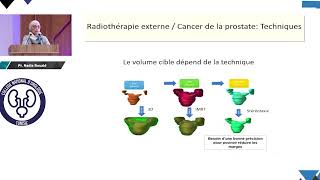 Radiothérapie : indications, modalités et résultats oncologiques