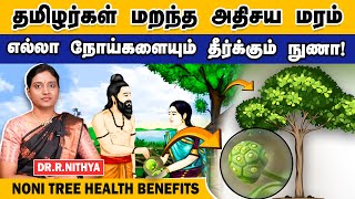 கேன்சர் முதல் அனைத்து நோய்களையும் சரி செய்யும் நுணா மரம் | NONI TREE HEALTH BENEFITS | Dr Nithya