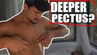 Does Pectus Excavatum Get worse with Age (Deeper Sunken Chest?)