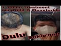 1 Tahun Setelah Menggunakan Minoxidil dan Finasteride