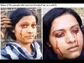 sweats blood from her eyes - breaking news - indian woman 'sweats' blood from her eyes