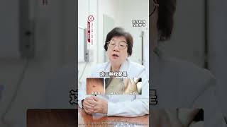 女生们不想被传染这3种HPV，注意分辨这些症状 HPV感染  丝状疣  扁平疣  跖疣  硬核健康科普行动