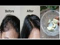 Grandma's SECRET Recipe for Hair growth in 30 days Garlic & Coconut hair oil treatment Grandma's SECRET Recipe for Hair growth in 30 days Garlic & Coconut hair oil treatment