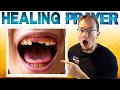 This EASY Prayer Will HEAL TEETH!!