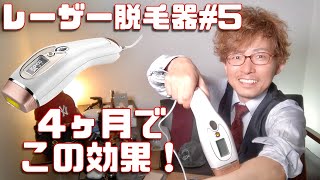 レーザー脱毛器レビュー#5！４ヶ月レビュー！効果絶大！