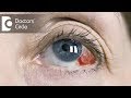 Causes of red clots in eyes - Dr. Mala Suresh Causes of red clots in eyes - Dr. Mala Suresh