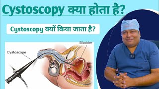 सिस्टोस्कॉपी सर्जरी क्या है और क्यों किया जाता है ? | Cystoscopy in Hindi | Dr Amit Kumar Jha