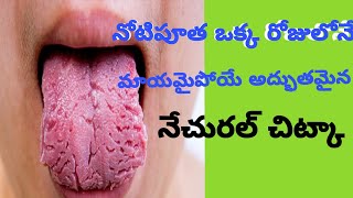 How to remove noti putha in telugu|నోటి పూత కి అద్భుతమైన నేచురల్ చిట్కా /#ismart parimala#