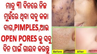 ମାତ୍ର ୩ ଦିନରେ ନିଜ ମୁହଁରେ ଥିବା ସବୁ କଳା ଦାଗ,PIMPLES,ଆଉ OPEN PORES କୁ ସବୁ ଦିନ ପାଇଁ ଗାୟବ କରନ୍ତୁ..IN ODIA