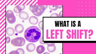 What is a Left Shift?-Hematology