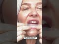 Watch her teeth whitening routine with MySweetSmile Teeth whitening strips.✨#teeth #smile #dental