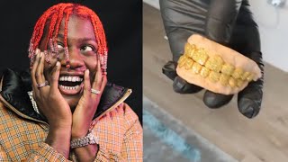 Lil Yachty Gets New Yellow Diamond Grill