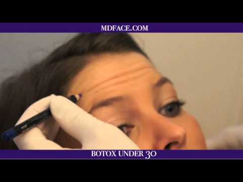 Botox Youtube