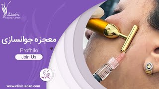 ژل پروفایلو