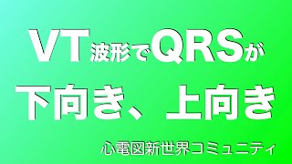 VT波形でQRSが下向きと上向きがあるのはなぜですか？と聞かれちょっとつまずいてます