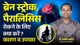 ब्रेन स्ट्रोक क्यों होता है? Brain Stroke Treatment: Causes \u0026 Non-Surgical Options | Dr. Amol Lahoti