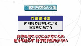 【知りたい！がん検診】Vol. 590回「大腸がんの治療法」