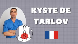 KYSTE DE TARLOVA