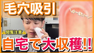 【いちご鼻】カメラ付き毛穴吸引器で角栓ごと引っこ抜く！？日本化粧品検定１級保有の美容オタクが恐る恐る挑んでみた！