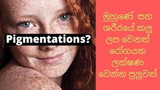 Pigmentations? මුහුණේ  සහ ශරීරයේ කලු ලප වෙනත් රෝගයක ලක්ෂණ වෙන්න පුලුවන්