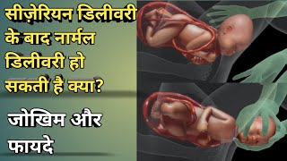 सीज़ेरियन डिलीवरी के बाद नार्मल डिलीवरी हो सकती है क्या ? | जोखिम और फायदे | medhealth support