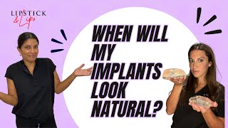 How Long Does it take for my Implants Settle after a Breast Augmentation?