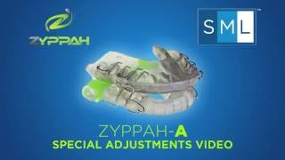 ZYPPAH Special Adjustments Video