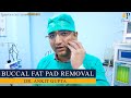 Buccal Fat Pad Removal Surgery and Double Chin Treatment | Dr Ankit Gupta live, New Delhi