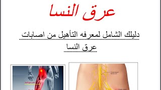 اتخلص من  عرق النسا | دليليك الشامل لعلاج آلام اسفل الضهر وتخديل الرجل مع مراحل التأهيل م